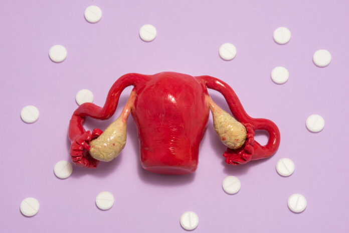 Modelo anatómico de útero femenino con ovarios está en el fondo púrpura con pastillas blancas alrededor, formando ornamento en lunares. Foto de arte conceptual para uso en ginecología, salud reproductiva de la mujer.