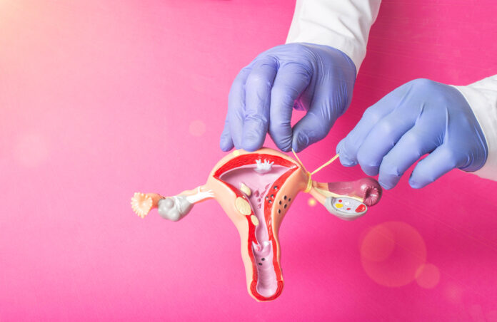 Arzt Gynäkologe ligiert die Eileiter auf dem Beispiel des Layouts des weiblichen Fortpflanzungssystems, rosa Hintergrund. Empfängnisverhütung Konzept für ungewollte Schwangerschaft, kopieren Raum für Text, Verfahren