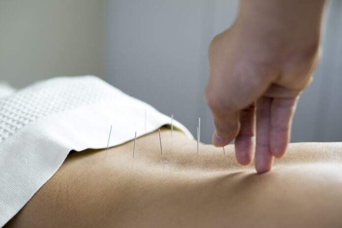 tratamiento de acupuntura tradicional