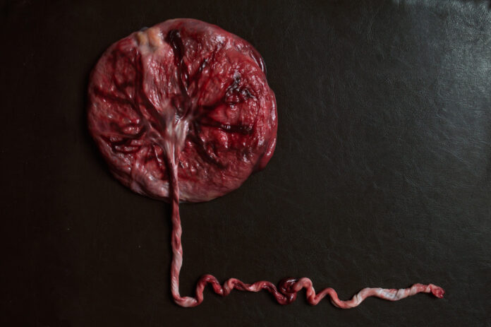 placenta simulando un árbol y su cordón umbilical el pasto