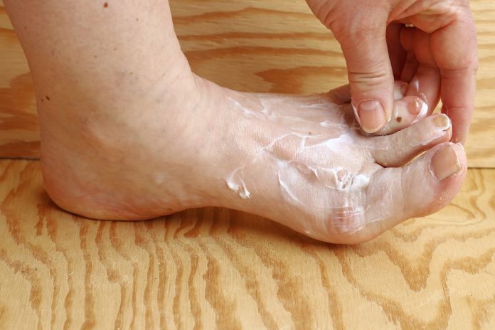 A woman puts some cream on her foot