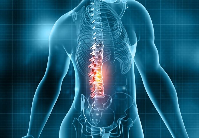 Human spine pain